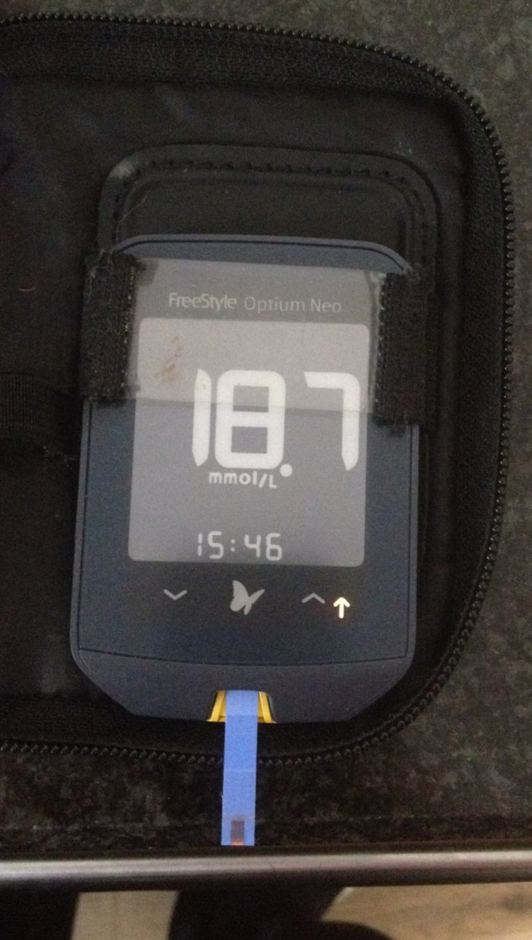 Poor Diabetes Management